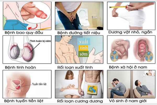 Các bệnh lý nam khoa thường gặp