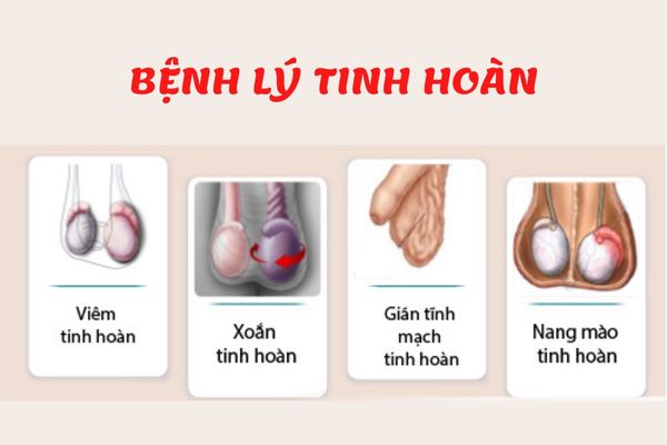 Có nhiều bệnh lý ảnh hưởng đến tinh hoàn nam giới