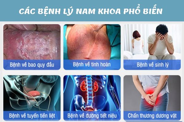 Các bệnh lý nam khoa được điều trị phổ biến