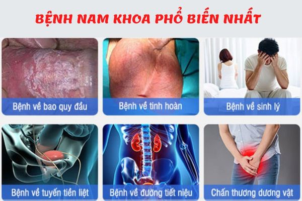 Có rất nhiều bệnh lý nam khoa ở nam giới