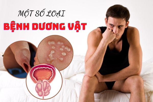 Điểm danh một số bệnh dương vật phổ biến ở nam giới