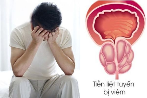 Bệnh lý về tuyến tiền liệt ảnh hưởng nghiêm trọng đến sức khoẻ