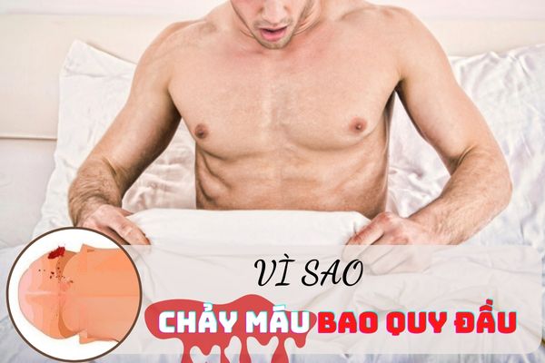 Vì sao nam giới bị chảy máu bao quy đầu?