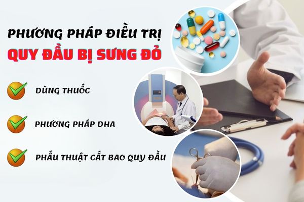 Phương pháp điều trị quy đầu bi sưng đỏ hiệu quả