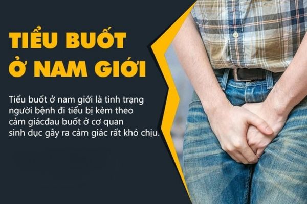 Tiểu buốt là bệnh lý thường gặp ở các cánh mày râu