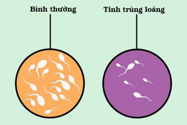 Tinh trùng loãng có số lượng tinh trùng ít hơn mức cho phép