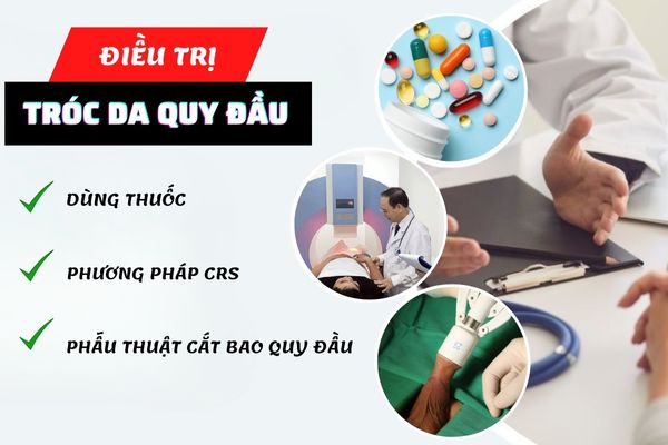 Các phương pháp điều trị tróc da quy đầu hiệu quả