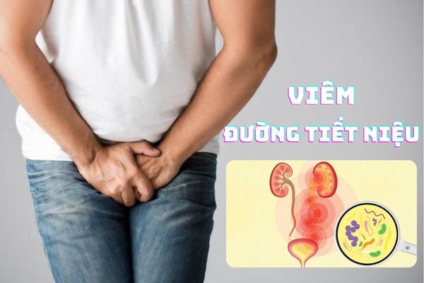 Viêm đường tiết niệu – Phát hiện sớm điều trị hiệu quả