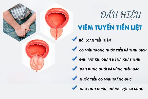 Viêm tuyến tiền liệt có nhiều triệu chứng nhận biết khác nhau