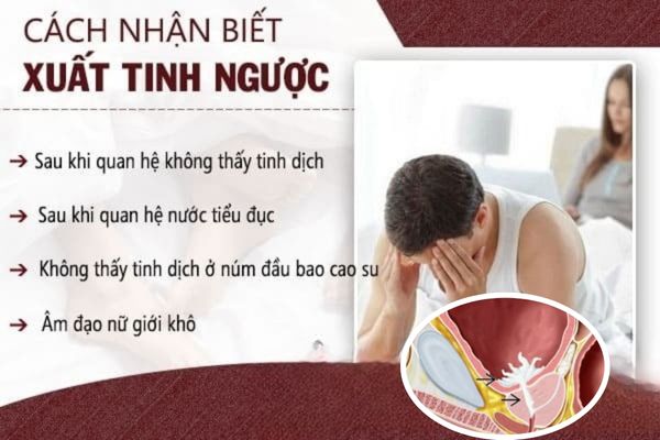 Dấu hiệu nhận biết xuất tinh ngược nên lưu ý