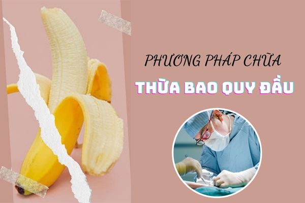 Cách chữa thừa bao quy đầu hiệu quả dành cho phái mạnh