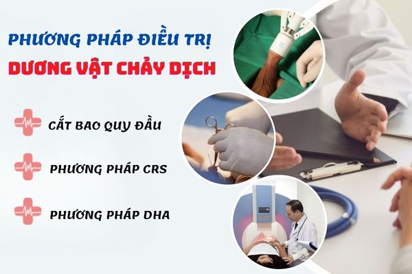 Phương pháp điều trị dương vật chảy dịch uy tín, chất lượng