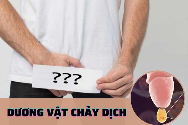 Dương vật chảy dịch cảnh báo bệnh lý gì? Cách điều trị hiệu quả