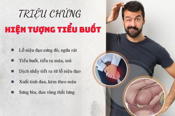 Triệu chứng nhận biết tiểu buốt thường gặp nhất