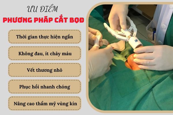 Cắt bao quy đầu - Phương pháp hiệu quả giải quyết thừa bao quy đầu