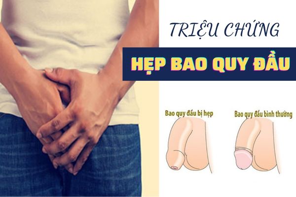 Nhận biết các triệu chứng hẹp bao quy đầu ở nam giới