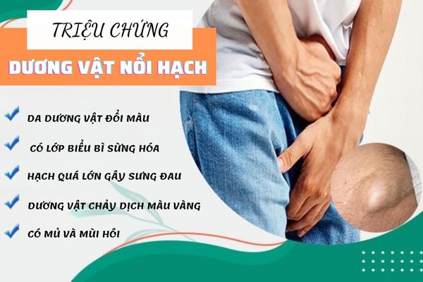 Dấu hiệu nhận biết nổi hạch dương vật