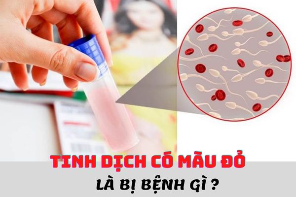 Tinh dịch có màu đỏ là bị gì? Có nguy hiểm không?