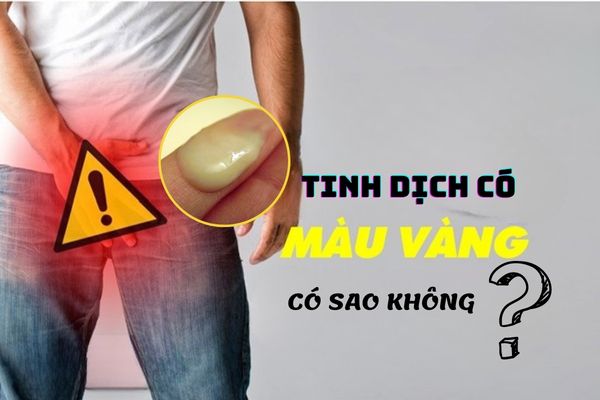 Nam giới xuất hiện tinh dịch có màu vàng có sao không?