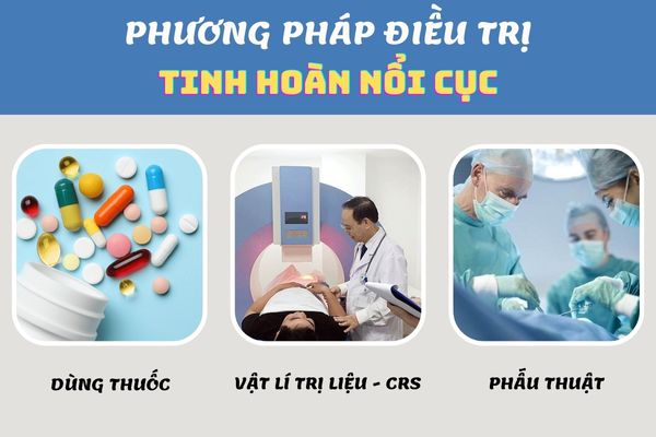 Phương pháp điều trị tinh hoàn nổi cục hiệu quả