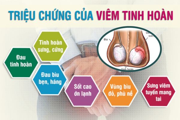 Dấu hiệu nhận biết bệnh viêm tinh hoàn ở nam giới