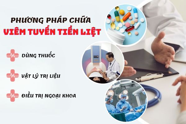 Các phương pháp chữa viêm tuyến tiền liệt hiệu quả, an toàn