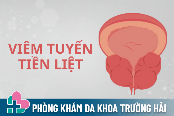 Cẩn trọng với bệnh viêm tuyến tiền liệt