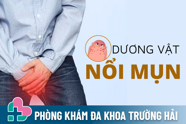 Dương Vật Nổi Mụn Là Do Đâu Và Điều Trị Ra Sao?