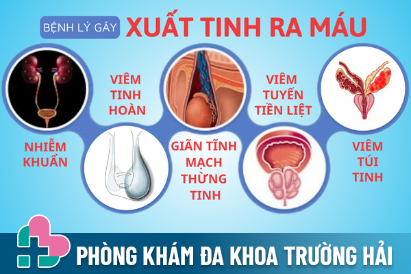 Xuat-tinh-ra-mau-co-the-dang-bat-bao-dong-nguy-hiem-2