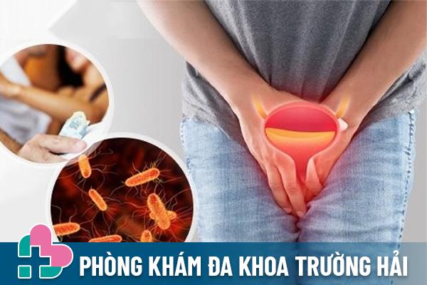 Thông Tin Cần Biết Về Viêm Bàng Quang