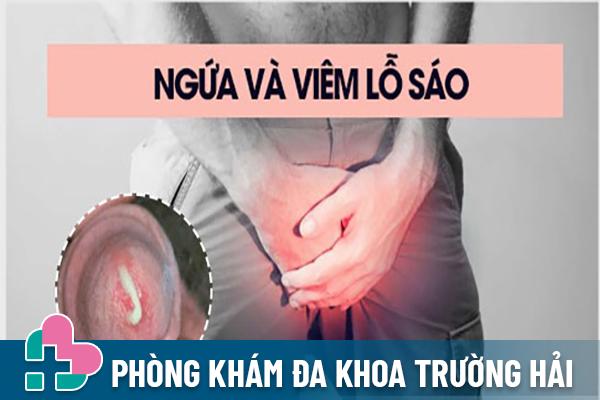 Ngứa Niệu Đạo Là Gì? Nguyên Nhân Và Dấu Hiệu Của Ngứa Niệu Đạo