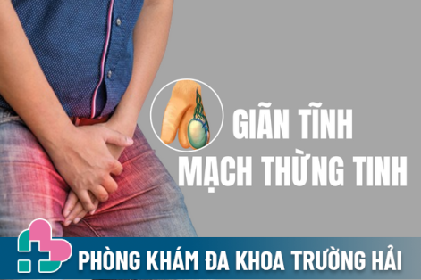 Giãn tĩnh mạch thừng tinh là bị gì?