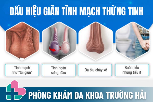 gian-tinh-mach-thung-tinh-la-bi-gi-1