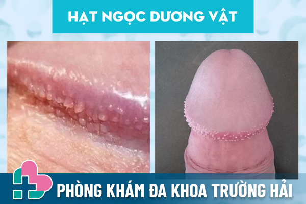 Su-that-ve-hat-ngoc-duong-vat-1