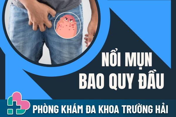 Bao Quy Đầu Nổi Mụn Là Do Đâu Và Điều Trị Ra Sao?